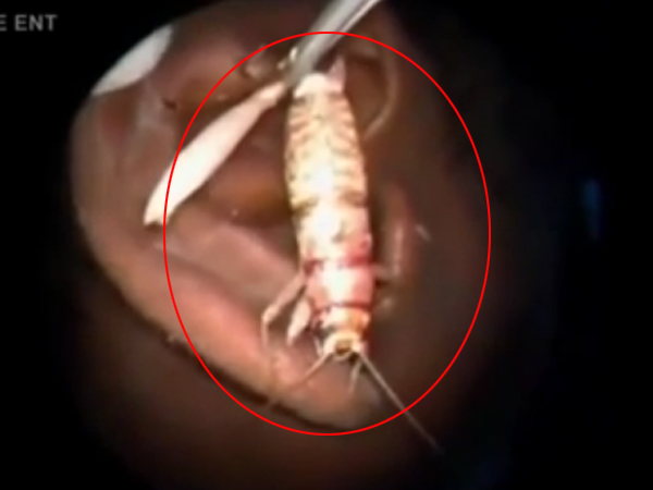 જીવતો હતો કિડો