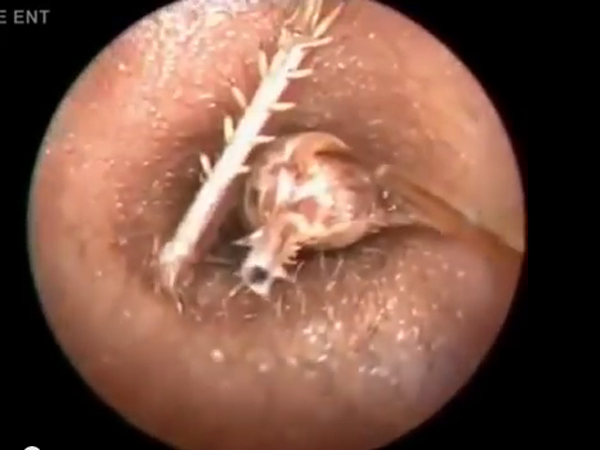 જીવતો કીડો હતો