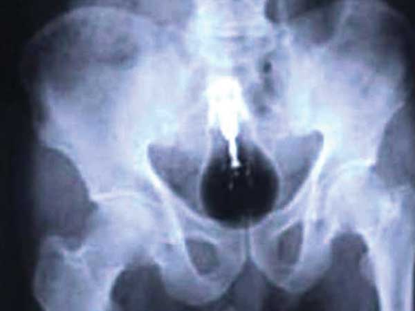 લાઇટ બ્લબ