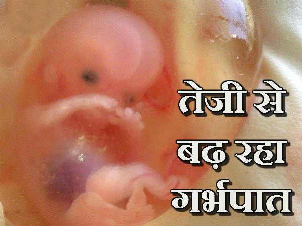 ગામડાં કરતા શહેરમાં વધુ ગર્ભપાત
