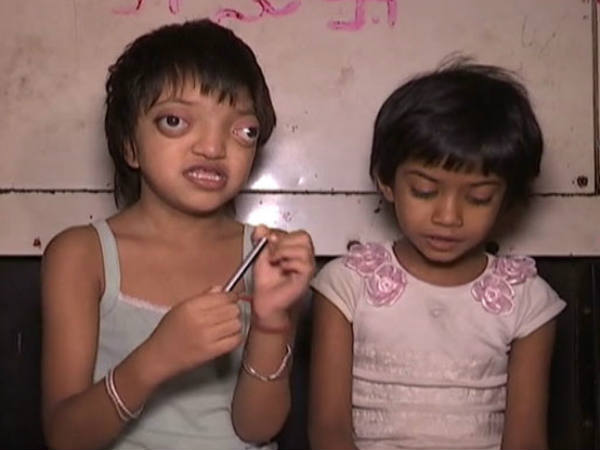 ભયંકર બિમારીથી જકડાઈ