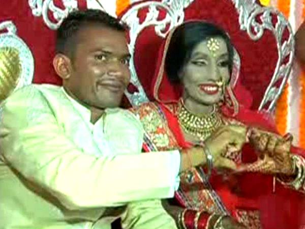એસિડ અટેક