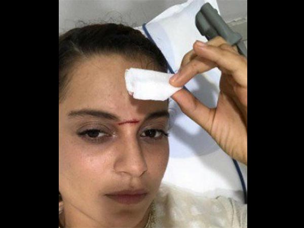 કપાળ પર થઇ ઇજા