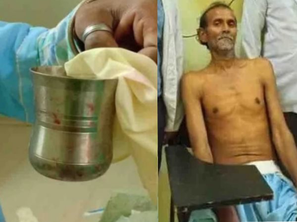 રેર ઓફ ધ રેરેસ્ટ કેસ