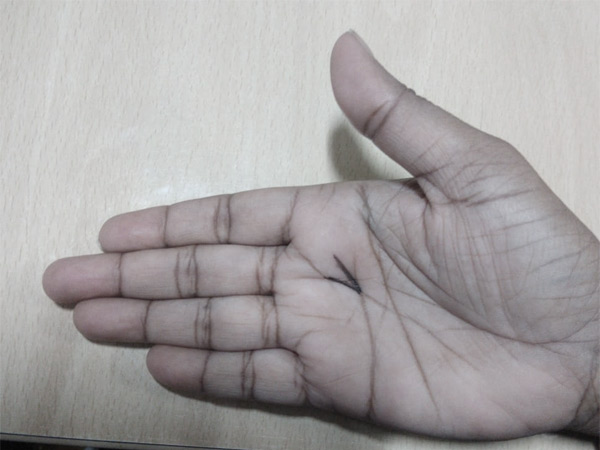 તૂટેલી હૃદય રેખા મષ્તિસ્ક રેખાને મળે