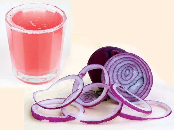 ડુંગળીનો રસ
