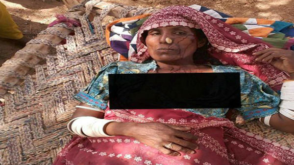 હિંદુ વિરોધી હિંસાના ફોટા પશ્ચિમ બંગાળના ગણાવીને વાયરલ કર્યા