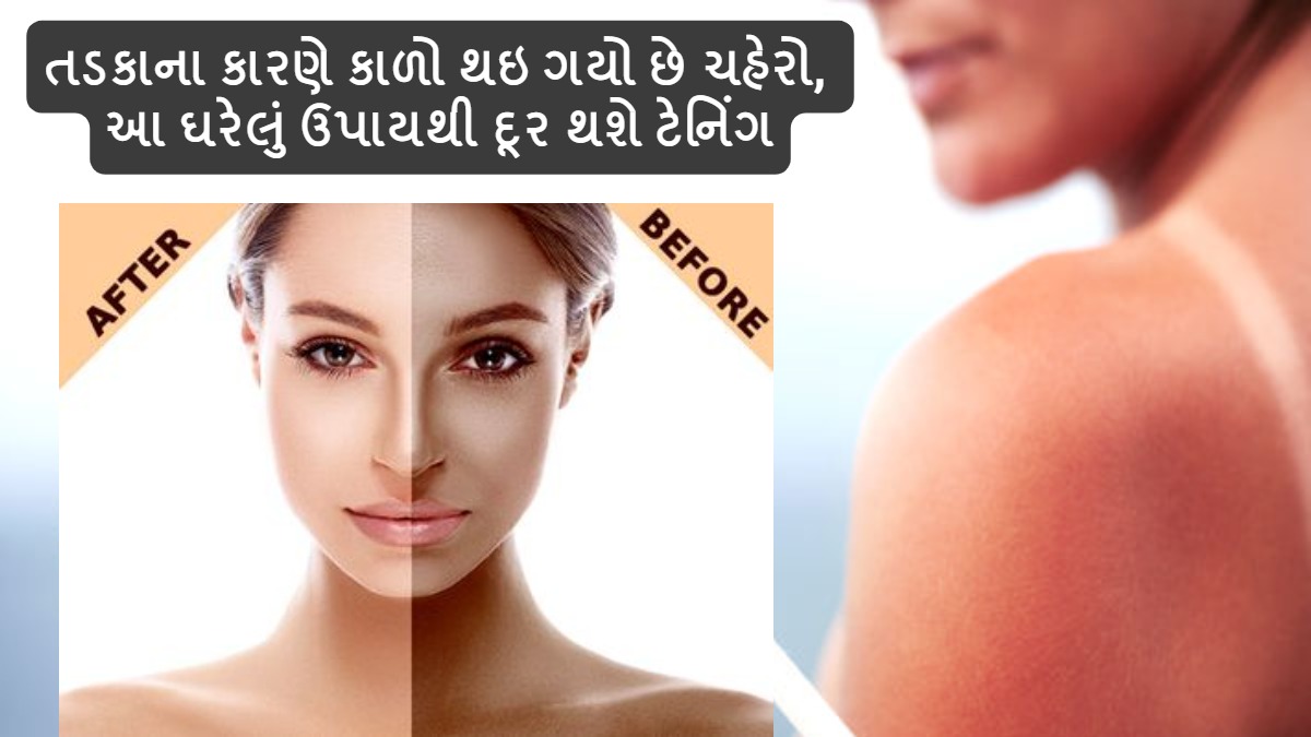 Skin Care Tips તડકાના કારણે કાળો થઇ ગયો છે ચહેરો, આ ઘરેલું ઉપાયથી દૂર